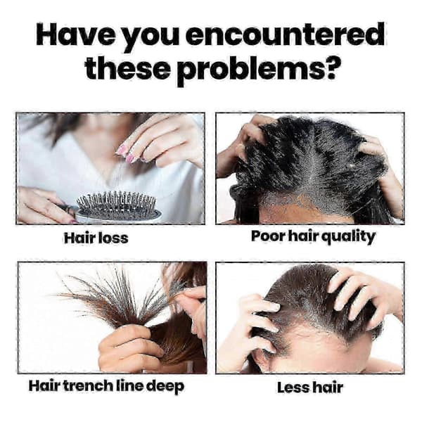 Hair Intensive Essence, Återfuktar Hårrötterna, Snabbväxande Förebygger Håravfall Och Stärker Hårvård Essence