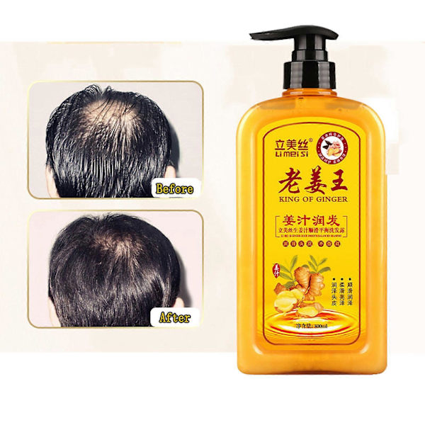 Ingefær Hårgenvækst Shampoo Ingefær Shampoo Til -Hårtab Hårshampoo Balsam