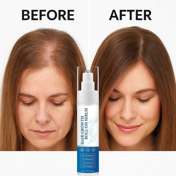 Hårväxtserum Roll-On med Rosmarin Närande Hårbottenbehandling Främjar Tillväxt Minskar Håravfall 25ML 3pcs