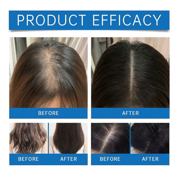 1-3X Avancerat Hårväxt Roll-On Serum Rosmarin Hårväxt Serum Roll On Förhindrar Håravfall Stimulerar Hårsäckar 2Pcs