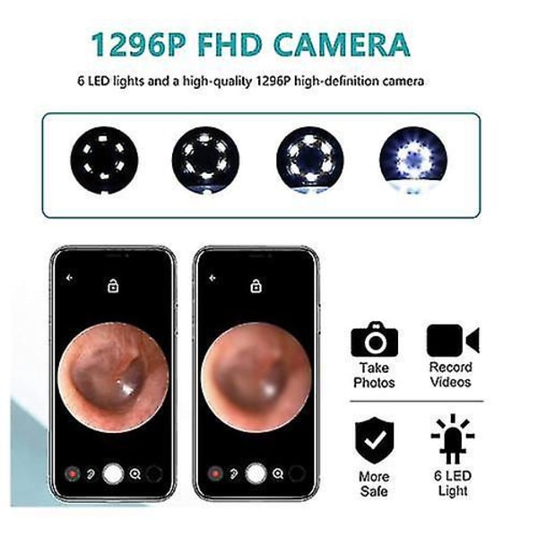 Wi-fi synlig vokselimineringsskje, usb 1080p Hd Load Otoscope