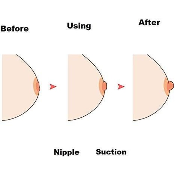 Nipplesucker Corrector for invertert, trekker eller forlenger låseassistentforsterker-sugere med støvtett etui