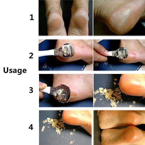 Professionel rustfrit stål hård hudfjerner med plasthåndtag, fodfil, hælfil, skrubber, pedicure, neglepleje