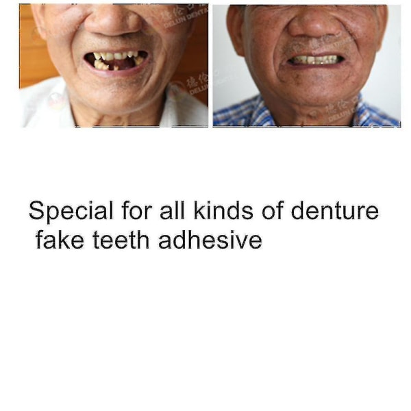 Tannprotese Oral falske falske tenner Smile Finer Paste bukseseler Selvklebende pulverlim tenner