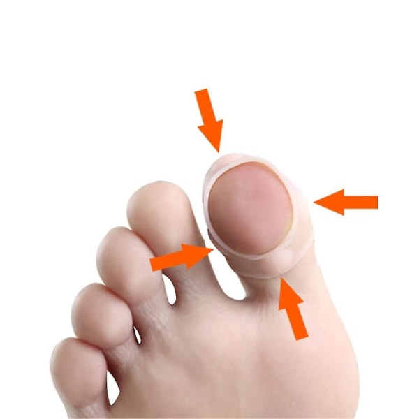 Korreksjonshylser for inngrodde tånegl, 4 par elastisk silikon Korreksjonsverktøy for inngrodde tånegl Tykk Paronychia behandlingskorrigerende stortåermer, tå