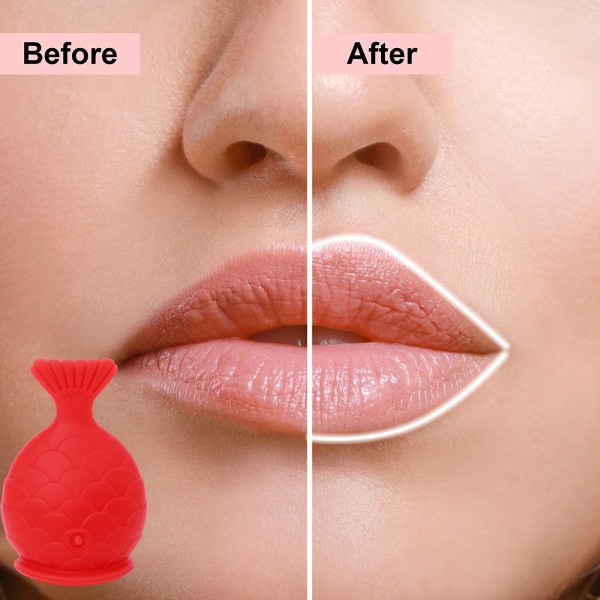 Lip Plumper Lips Enhancer Plumper Device Læber, Silikone Fish Shape Lip Enhancer Plumper Device, til sexet mund til kvinder