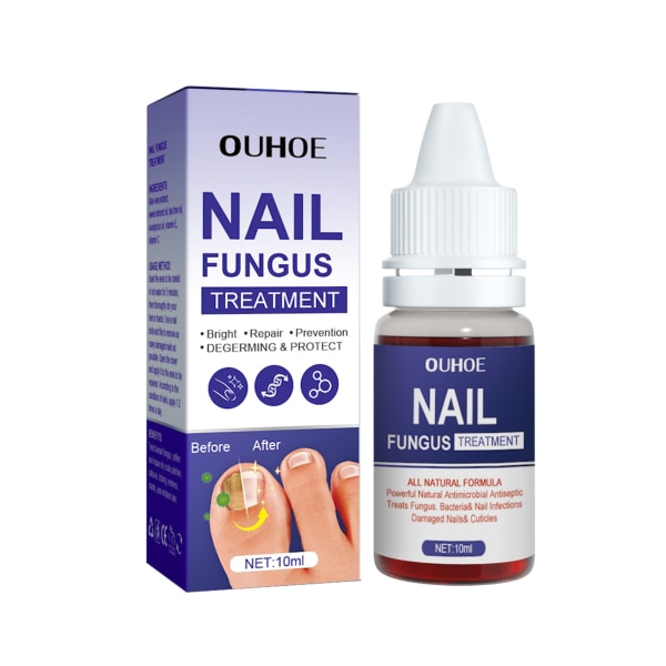 Nagelreparation Antibakteriell lösning Snabbverkande nagelmissfärgningsbehandling för svaga spruckna delade naglar default
