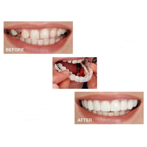 1/2 st Smile Denture Fit Flex Cosmetic Teeth Bekvämt cover 2pcs