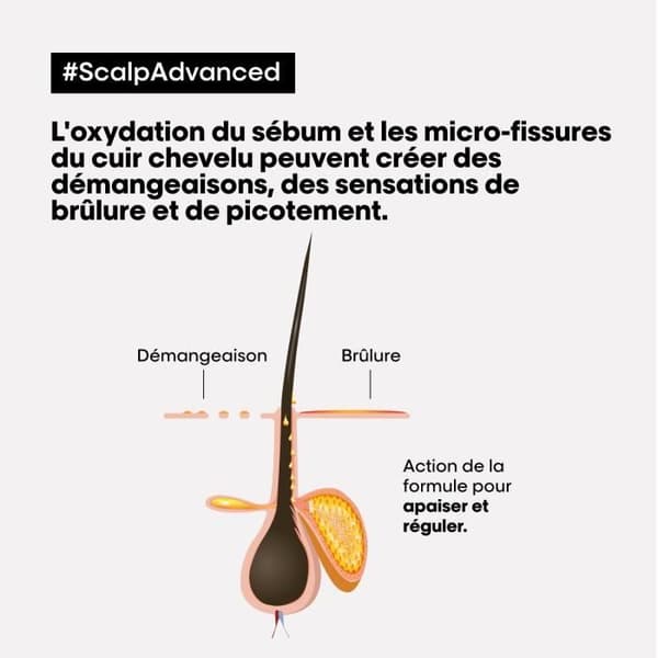 L'Oréal Scalp Advanced 2-in-1 Clay 250 ml