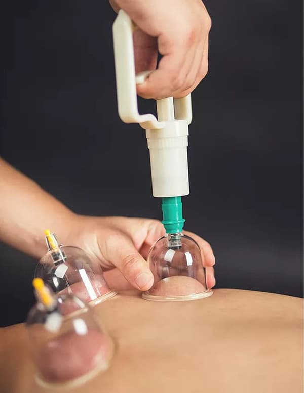 Cupping with vacuum pump for treatment and massage 12 pcs