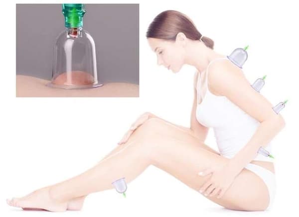Cupping Sæt med Vakuumpumpe - 12 dele