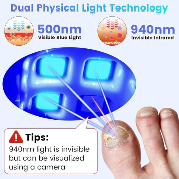Nagelsvampslaser, Nagelreparation för tår, Säker och effektiv hembehandling, Lasernagelterapi