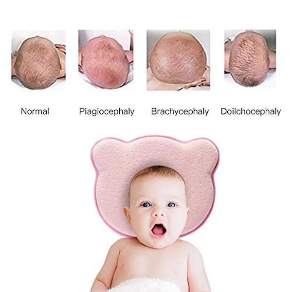 Baby mot flatt hode, ortopedisk baby