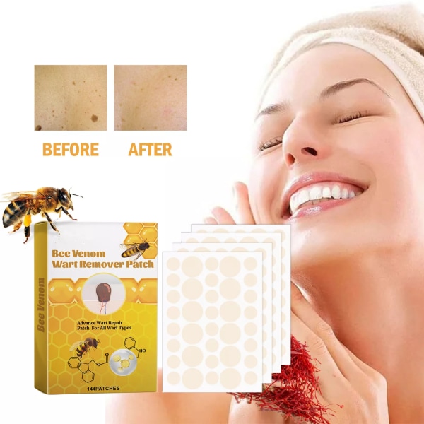 144 st Bee Venom Skin Tag Remover-plåster, Bee Venom Mullvads- och vårtplåster, majsmullvadar Vårtborttagningsdekaler