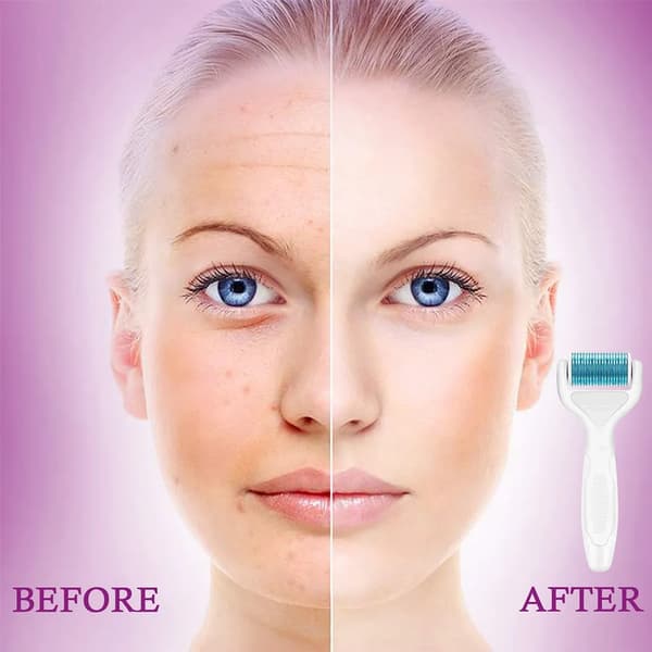 6-i-1 Microneedle Derma Roller för ansiktsvård, anti-rynk, bristningar, håravfall