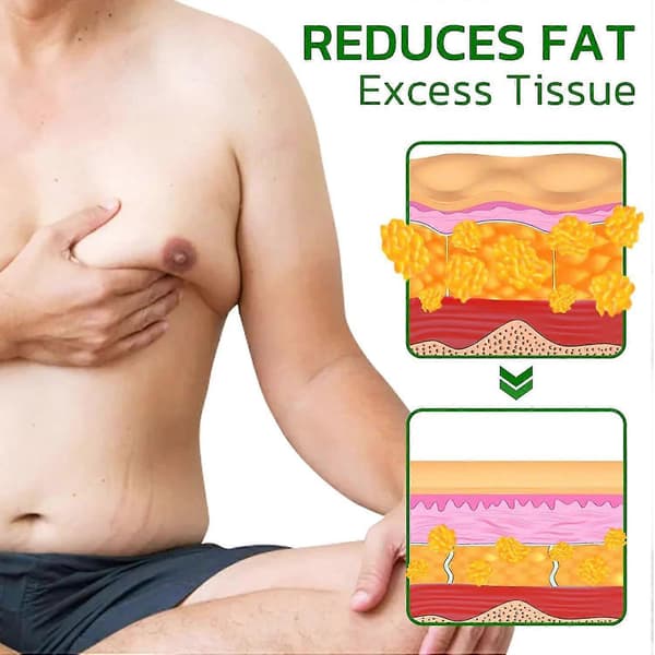 Gynekomasti Kompress Patch - Turmericmax, Ingefær Patch for Cellulittsmelting 3 boxes 36 Pcs