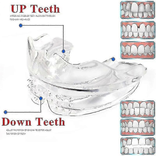 Dental Ortodontisk Tandkorrigerare Silikon Tandställning Retainer Rätverktyg Tandskydd För Vuxna