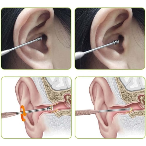 Ørepropper og voksverktøysett, med en ørepinneoppbevaringsbøtte Enkel å bruke 6-delt profesjonelt ørerensingsverktøysett for voksne menn kvinner