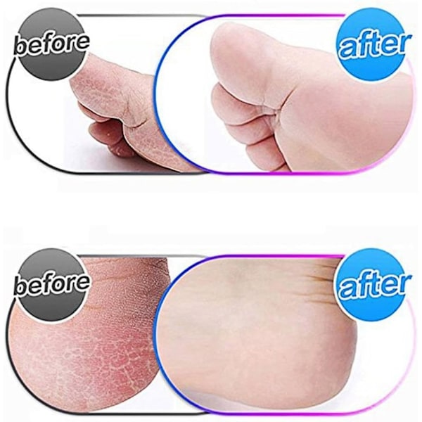 Förpackning med 12 extra utbytesrullar för Amope Medi, kompatibla med Foot File 6 & 6