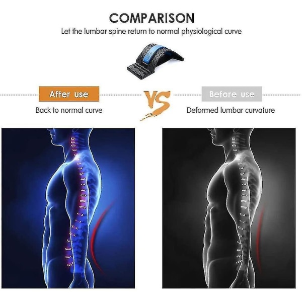 Backright Lumbar-venytyslaite - Selän rentoutumiseen, skolioosiin (sininen + musta)