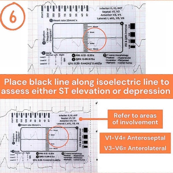 EKG 7-stegs Linjal, EKG Linjal Plastlinjal Mätverktyg