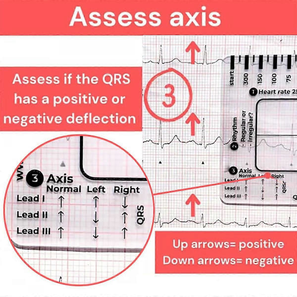 EKG 7-stegs Linjal, EKG Linjal Plastlinjal Mätverktyg