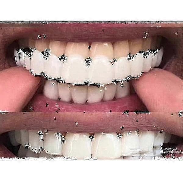Ylä-/alalohko Comfort Fit Flex -valkaisevat hammasproteesit Upper lower teeth