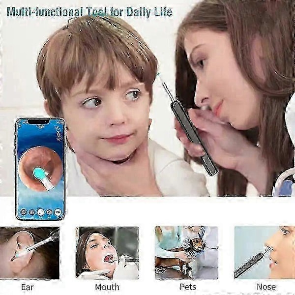 Langaton Älykäs Visuaalinen Korvanpuhdistin USB WiFi Otoskooppi TW1 Korvavahan Poistotyökalusetti Kameralla Korvan Tähystin HD 1080P iPhone iPad Androidille Black
