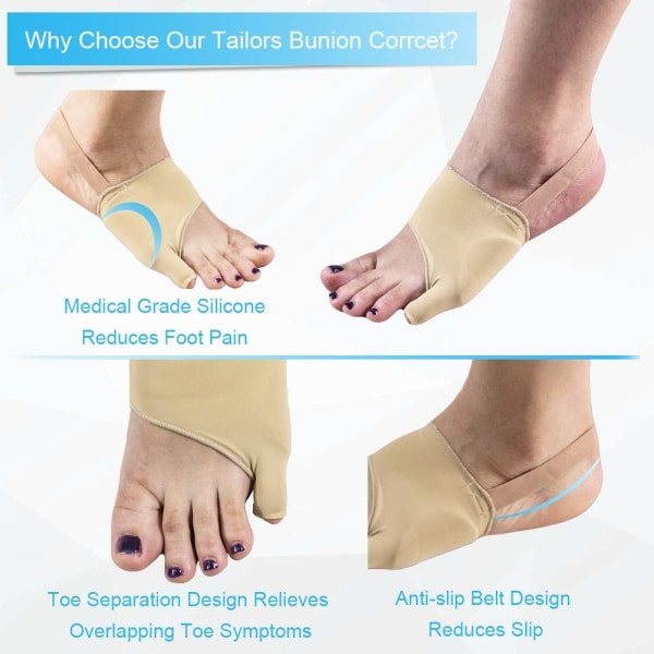 Skräddarsydda hallux valgus-korrigerare, hallux valgus-dynor för hallux valgus och lilltå