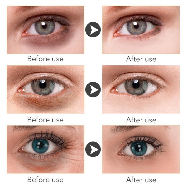 Retinol Eyes Creams Anti Puffiness Gel Omedelbar borttagning av øyepåsar
