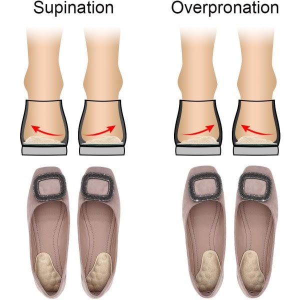 Korrigerande skoinsatser för supination og överpronation. Medial og lateral