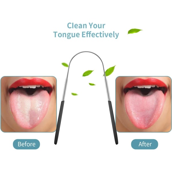 4 stk tungeskraper, reduserer dårlig ånde Tungrensing Stai