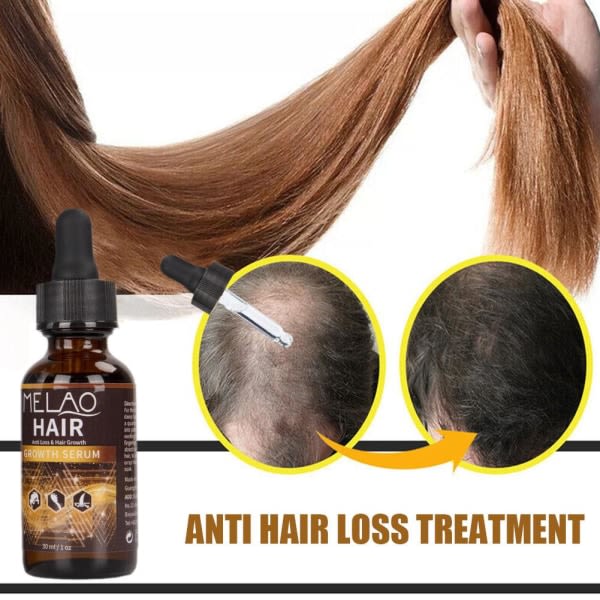 Hair Root Essence Liquid Anti-håravfallsbehandling