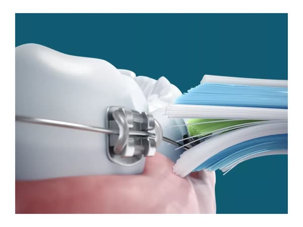 Philips Sonicare 5500 series HX7111 Elektrisk Tandbörste svart
