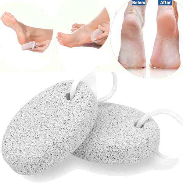 Pumice Stone For Feet 2 Pcs Set_fotpleie Naturlig Pimpsten For Død Hard Hud_fot Scrubber Calluses Fjerner