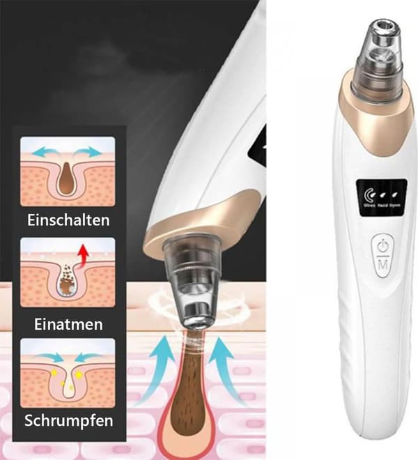Blackhead Vacuum, Pore Cleaner, Comes with 6 Replaceable Suction Nozzles for Deep Pore Cleansing, USB Rechargeable.