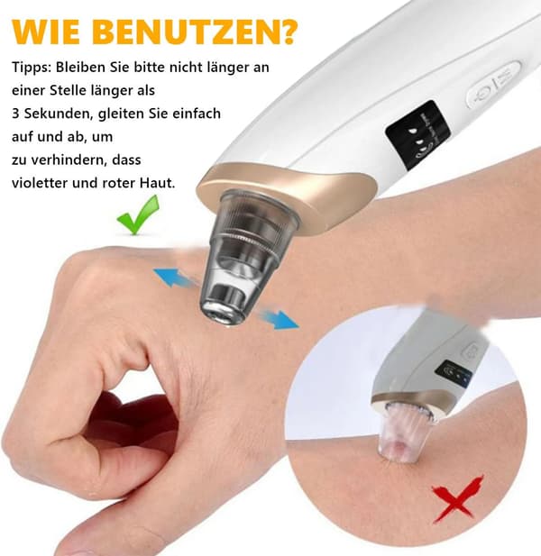 Blackhead Vacuum, Pore Cleaner, Comes with 6 Replaceable Suction Nozzles for Deep Pore Cleansing, USB Rechargeable.