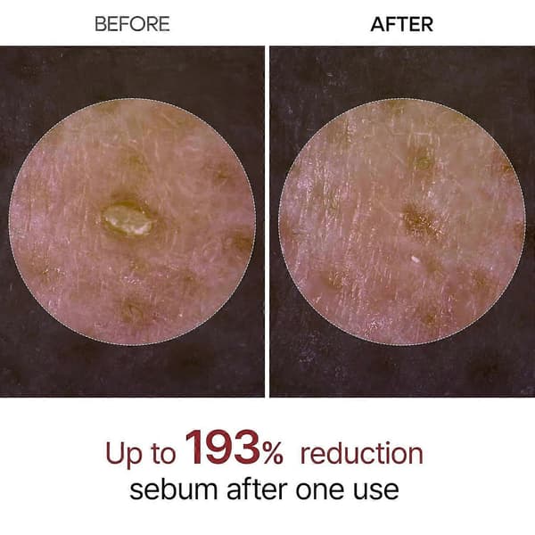 2PCS Dr.Melaxin PEEL SHOT GLOW EXFOLIANT RICE AMPOULE (VITT RIS/SVART RIS)