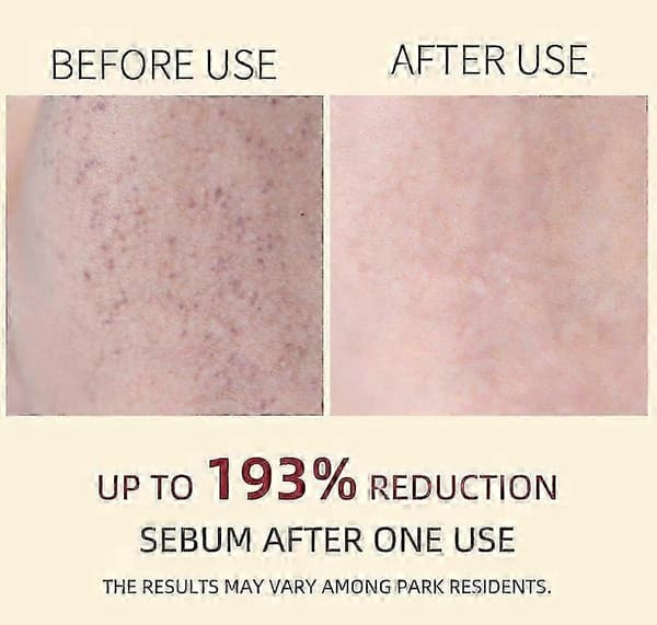 1-3x Peel Shot Glow Exfoliant Ris Ampul (Hvid/Sort Ris), Blid Eksfolierende Ansigts- & Kropsskrub Død Hud, Fjernelse af Hudorme (3 sæt)