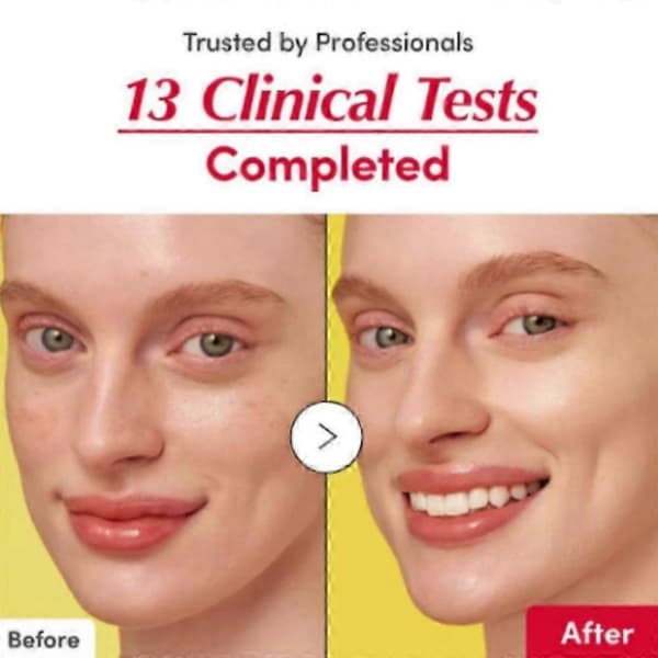 Anti-aldring Vitamin Lysende Serum 30ml (Gul)