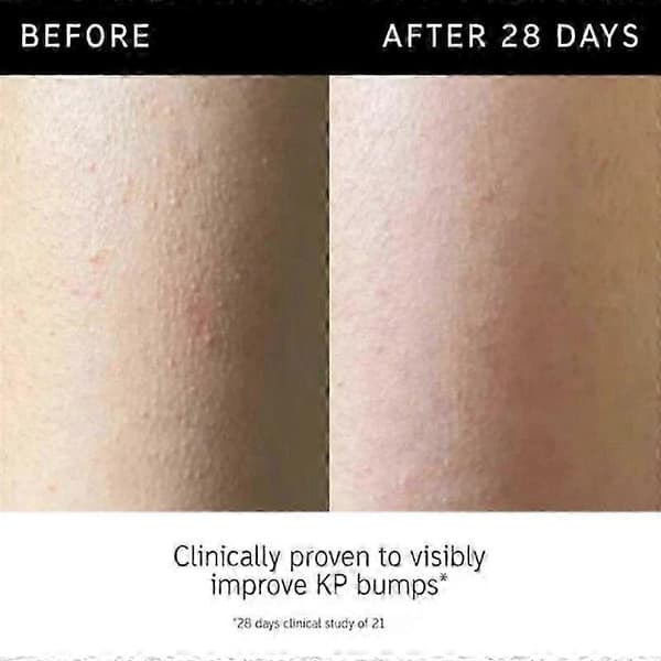 The INKEY List Glycolic Acid Eksfolierende Kropsstick 45g 25-26（5 stk）