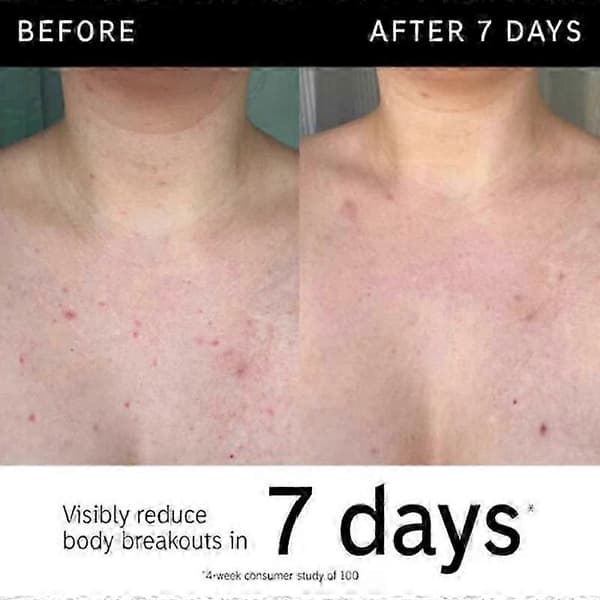The INKEY List Glycolic Acid Eksfolierende Kroppsstift 45g 25-26（5stk）