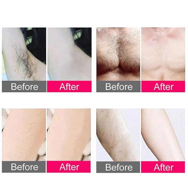 IPL Hårfjerning Laser Epilator 300.000 Flash Barbering og