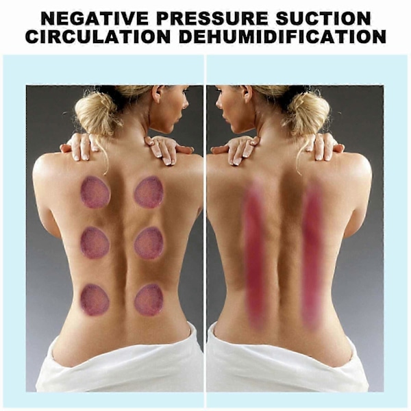 Koppesæt Gua Sha Massage Trykaflastning Opvarmning Trykaflastning 12 Tilstande Smart Elektrisk Koppe Bærbar green
