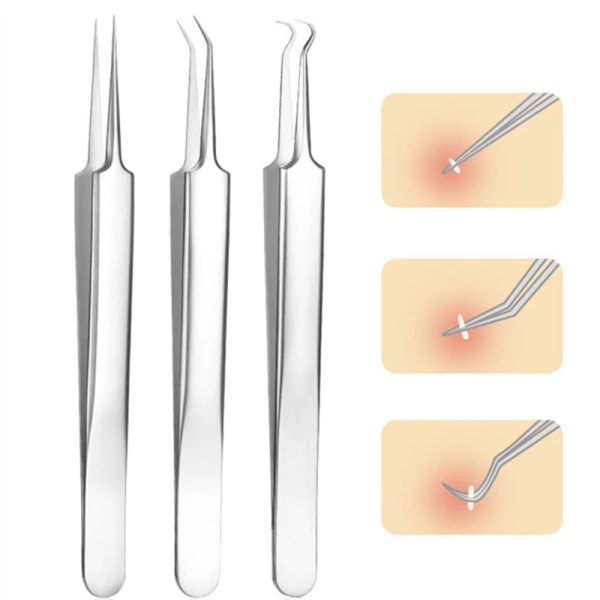 Brukervennlig Pinsett i Rustfritt Stål MOT AKNE Bölj (C)