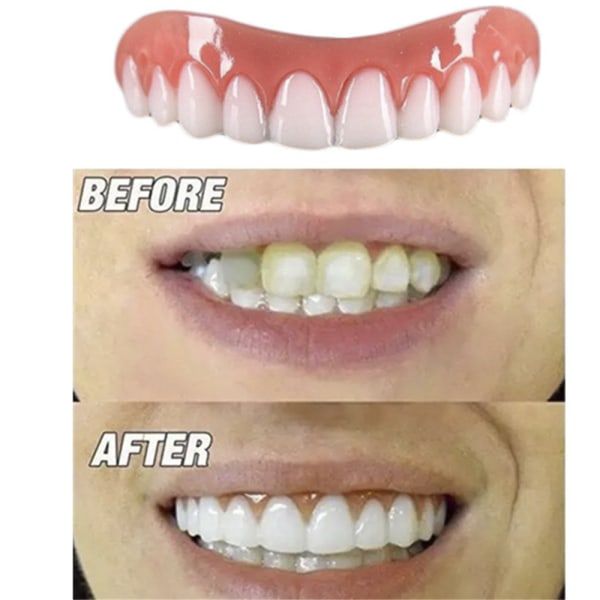Falska Tänder för Övre Tandrad
