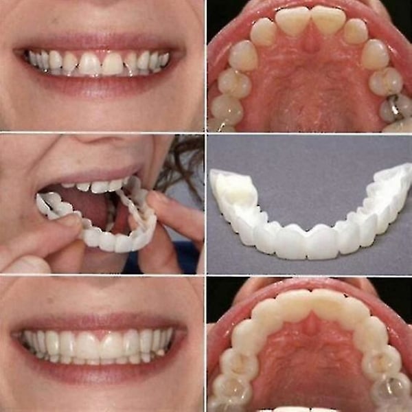 Ett par övre och undre högkvalitativ protes Omedelbart leende Komfort Fit Flex Kosmetiska tänder Tandprotes Tänder Topp kosmetisk faner Perfekt