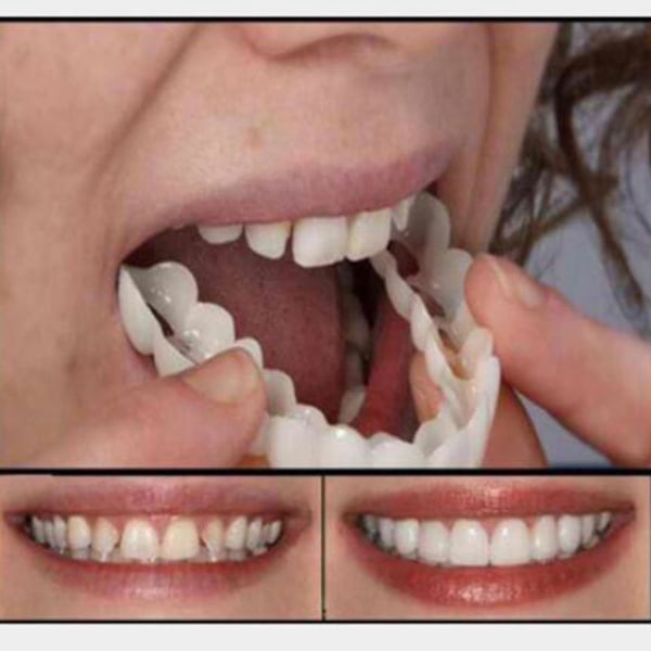 2xbløde silikoneprotese tænder Finér Midlertidige falske tænder øverste top