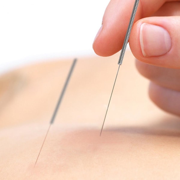 500 st engångs sterila akupunkturnålar med 50 st styrrör (0,20*25 mm), akupunkturnålar Healthys Care Product (0,20X25 1 tum)