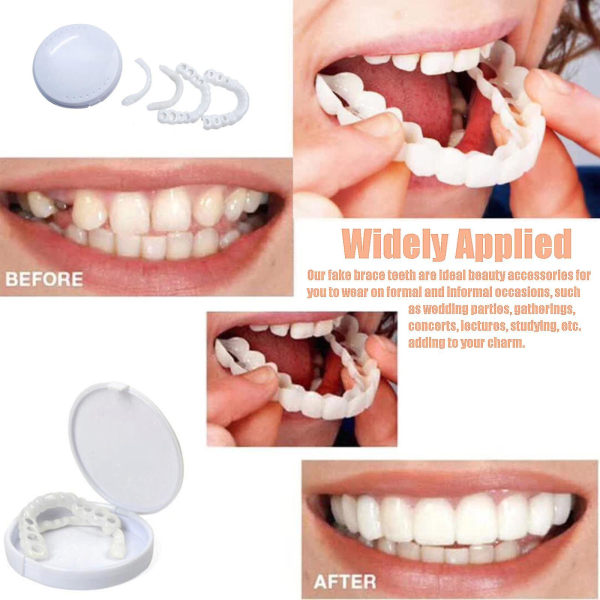 Nya Snap On Teeth faner, perfekta tänder tillfälligt utbyte, friska Creative Smiling Faner (vit)